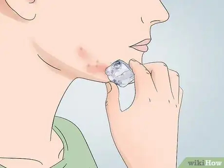 Image titled Cover Inflamed Pimples Step 1