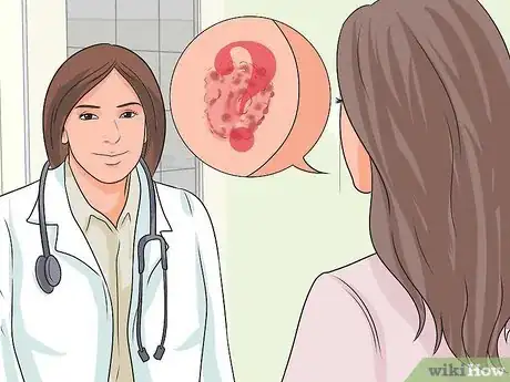 Image titled Treat Itchy Breasts Step 21