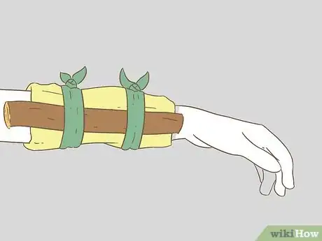 Image titled Apply Splints Step 7