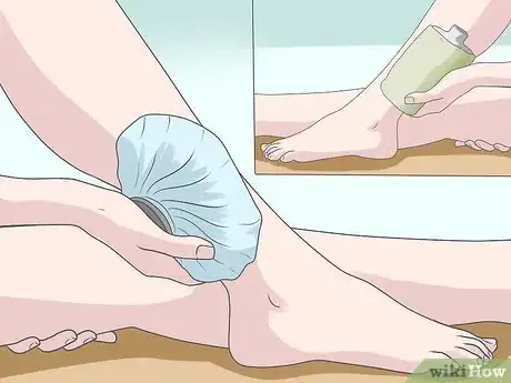 Image titled Relieve Sciatica Pain During Pregnancy Step 2