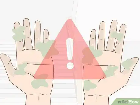 Image titled Handle a Lupus Flare Step 15