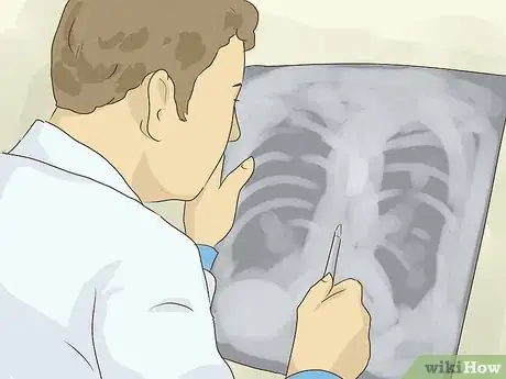 Image titled Test for Tuberculosis Step 18