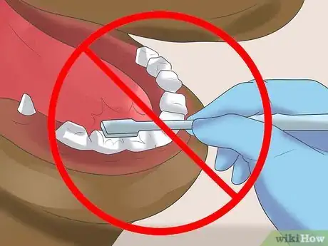 Image titled Take Proper Care of Your Horse's Teeth Step 12