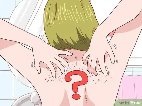Image titled Get Rid of Itchy Skin with Home Remedies Step 23