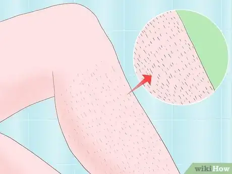 Image titled Deal with Thick Leg Hair Step 1