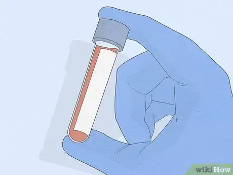 Image titled Find a Neurologist Step 5