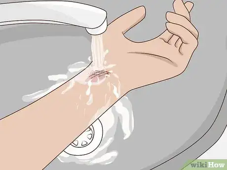 Image titled Use Honey as a Topical Antibiotic Step 3