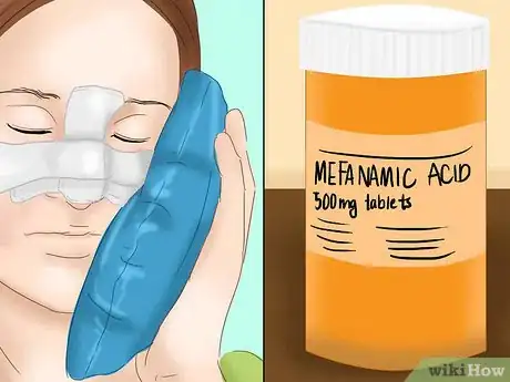 Image titled Heal After Plastic Surgery Step 2