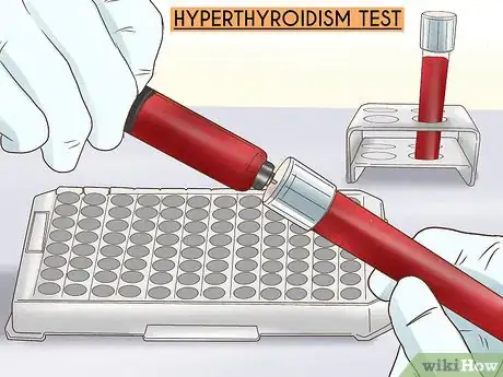 Image titled Diagnose the Cause of Essential Tremor Step 4