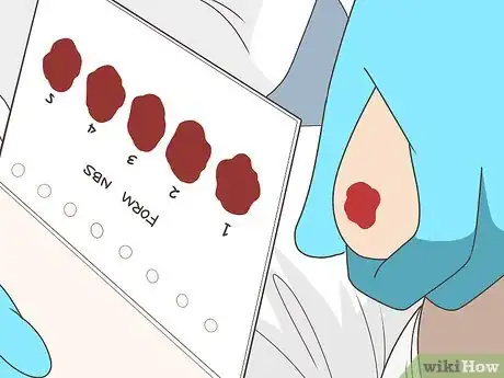 Image titled Diagnose Spinal Muscular Atrophy Step 10