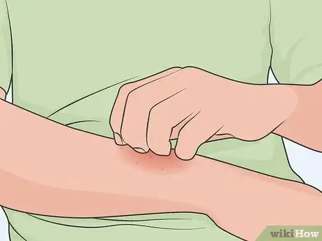 Image titled Take Gabapentin Step 09