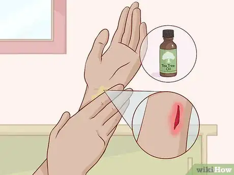 Image titled Treat Skin Conditions with Tea Tree Oil Step 9