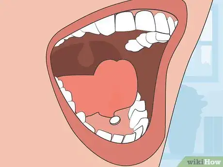 Image titled Take Zubsolv Step 3