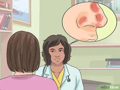 Image titled Control Rosacea Step 7