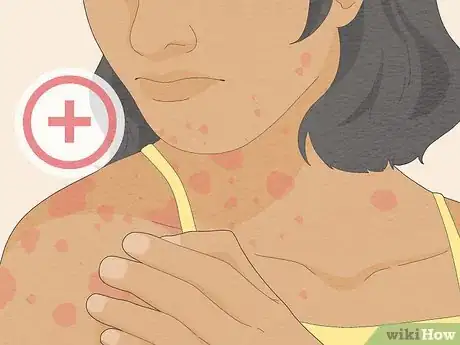 Image titled Use Atomoxetine Step 7