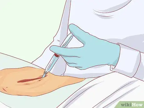 Image titled Know if You Have Spondylosis Step 15