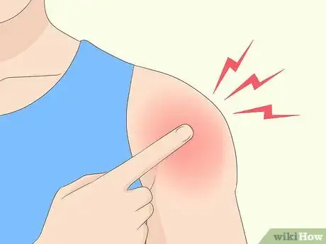 Image titled Identify a Rotator Cuff Injury Step 2