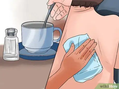 Image titled Treat Winter Eczema Step 7