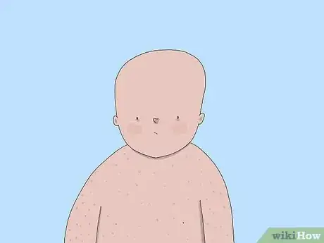Image titled Prevent Ear Infections in Babies Step 12