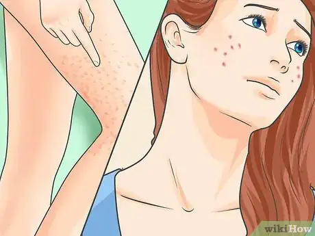 Image titled Diagnose Adult Onset Allergies Step 3