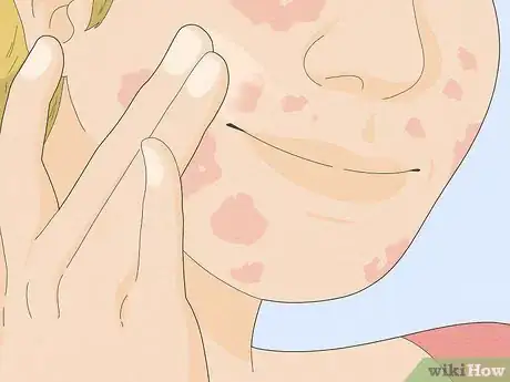 Image titled Wear Makeup when You Have Eczema Step 10