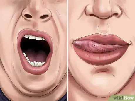 Image titled Approach an Unfamiliar Dog Step 5