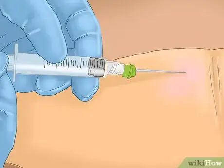 Image titled Treat Multiple Myeloma Step 4