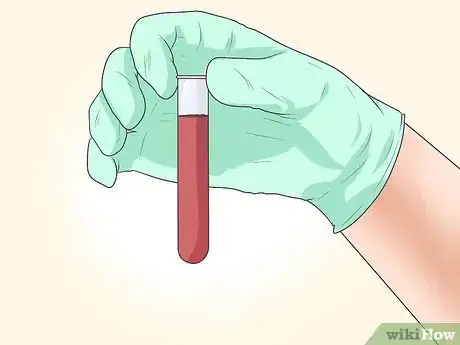 Image titled Prevent Recurrent Miscarriages Step 2