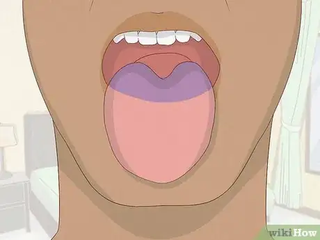 Image titled Prevent Heartburn Step 10