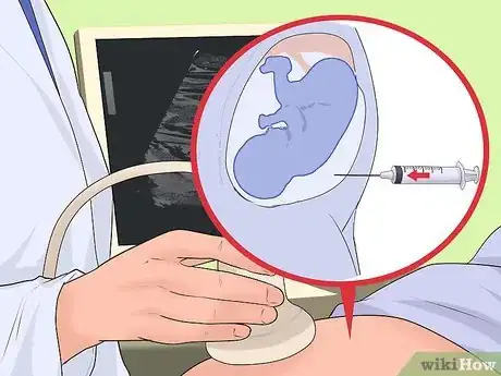 Image titled Test for Down Syndrome Step 6