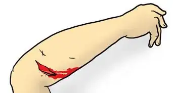 Complete a Top to Toe Assessment of an Injury