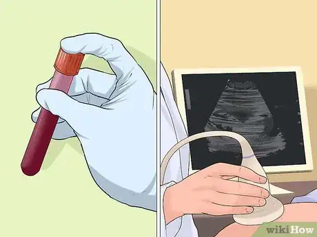 Image titled Test for Down Syndrome Step 2