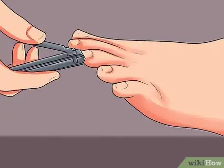 Image titled Soothe Sore Feet Step 7