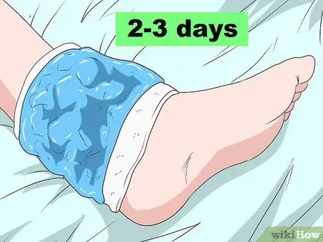 Image titled Treat Achilles Tendon Rupture Step 10
