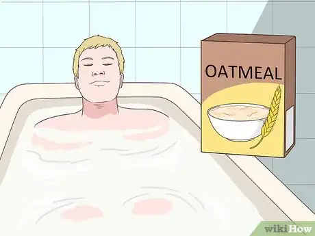 Image titled Heal Red Skin Step 6