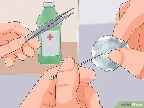 Image titled Remove Fiberglass Slivers from Your Skin Step 9