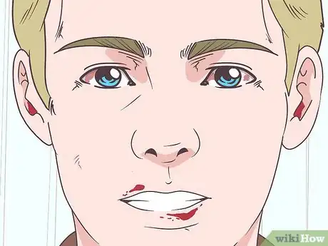 Image titled Recognize Signs and Symptoms of Ebola Step 6