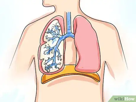 Image titled Recognize and Prevent Valley Fever (Coccidioidomycosis) Step 3