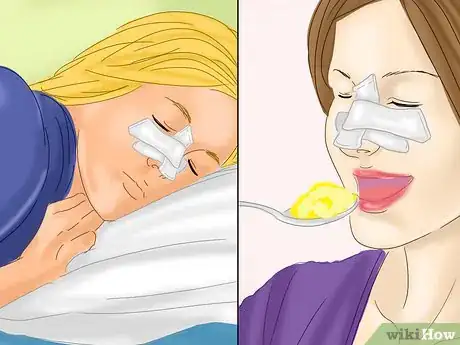 Image titled Heal After Plastic Surgery Step 5