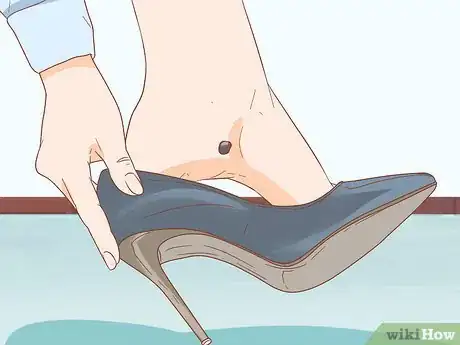 Image titled Treat a Blood Blister Step 1