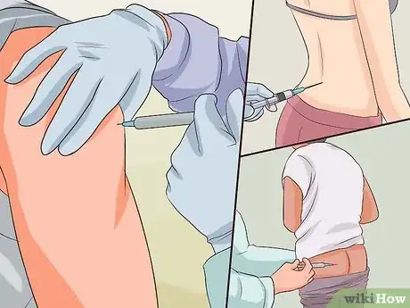 Image titled Get an Injection Without It Hurting Step 1