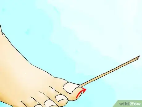 Image titled Get Perfect Feet for Summer Step 03