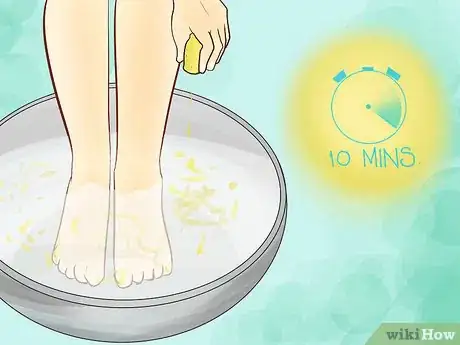 Image titled Use Foot Baths for Athlete’s Foot Step 19