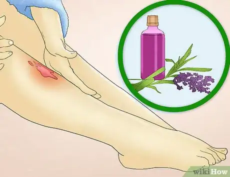 Image titled Reduce Redness After Waxing Step 12