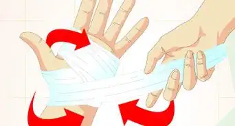 Care for Superficial Wounds