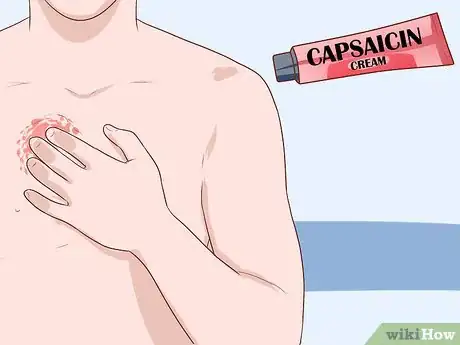 Image titled Manage Pain with Herbs Step 9