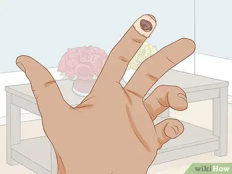 Image titled Treat a Blood Blister Step 5