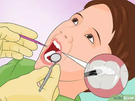 Image titled Protect Your Child's Teeth Step 14