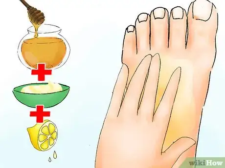 Image titled Get Perfect Feet for Summer Step 07
