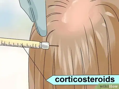 Image titled Treat Women's Hair Loss Step 19